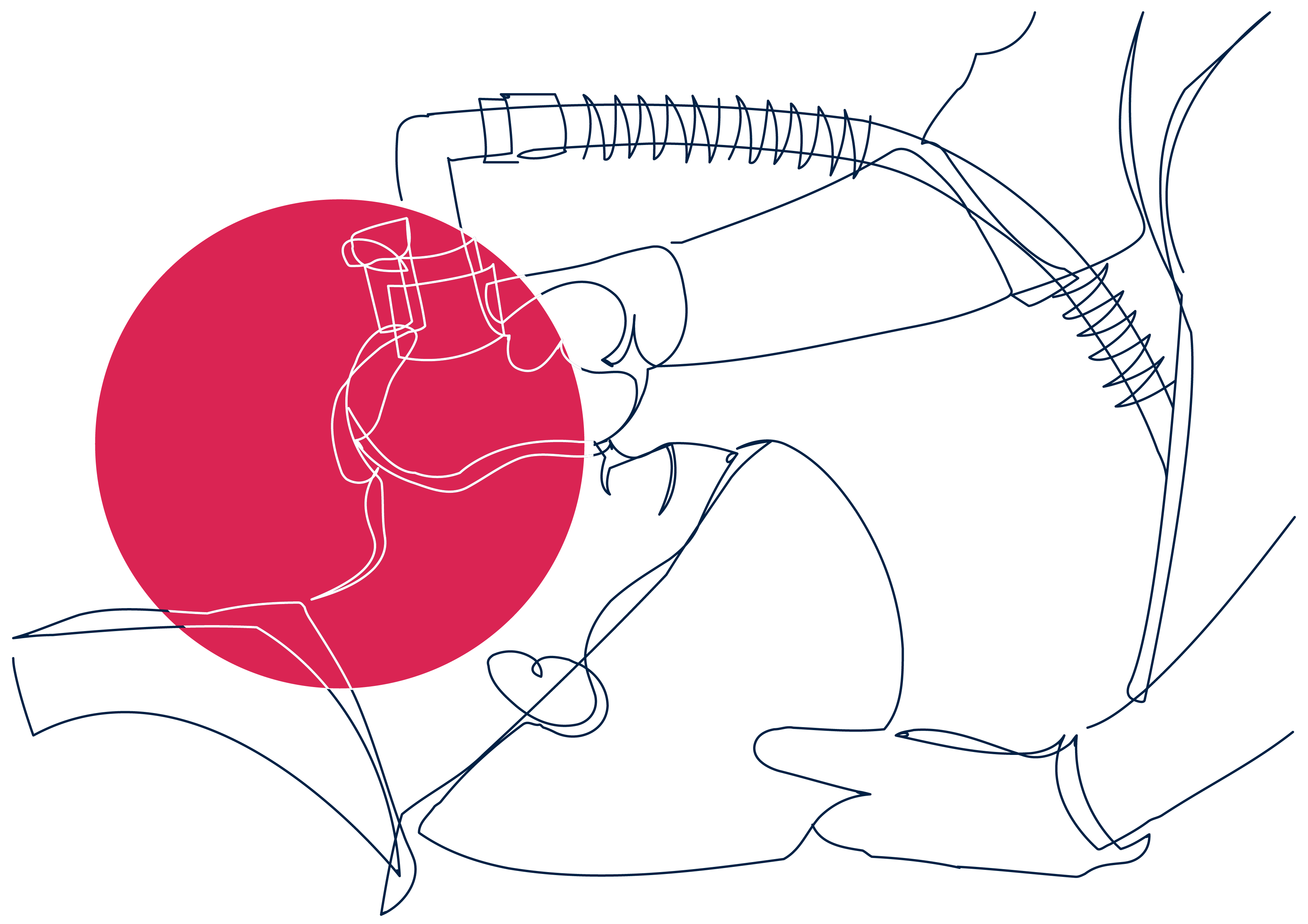 anesthesia illustration
