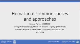 May 1, 2024: Hematuria: Common Causes and Approaches by Dr. Connor Forbes