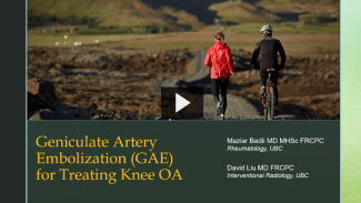 Geniculate Artery Embolization (GAE) for Treating Knee OA by Dr. Maziar Badii &amp; Dr. David Liu