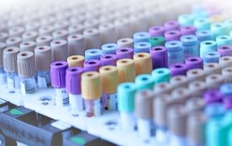 Image of blood samples tubes in laboratory testing tray